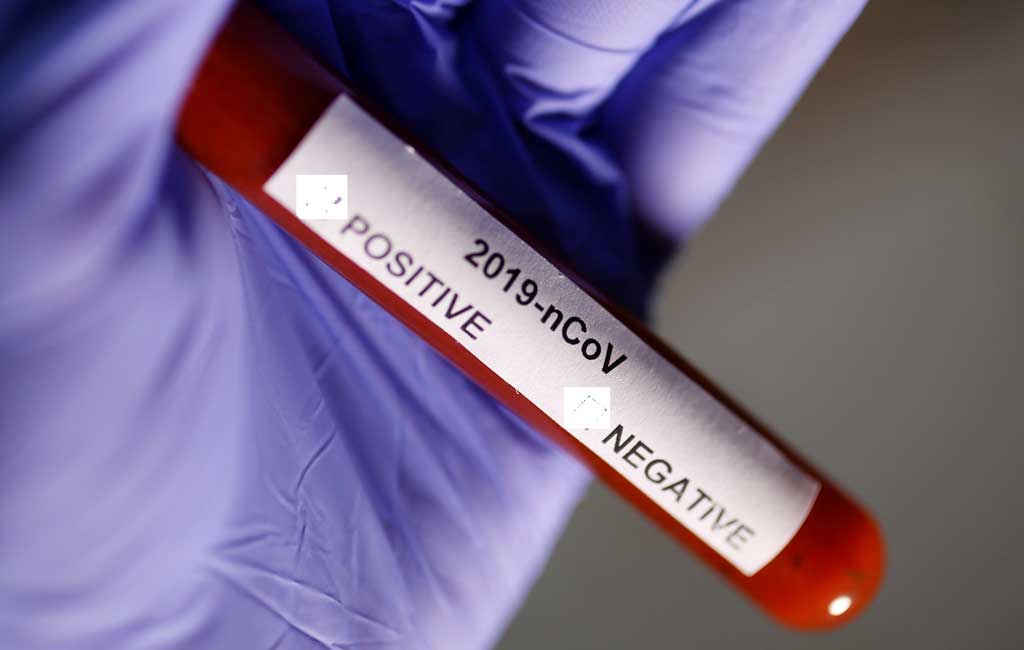 Coronavirus 2 Autoridades: 6 mil pacientes com coronavírus receberam alta em hospitais de NJ