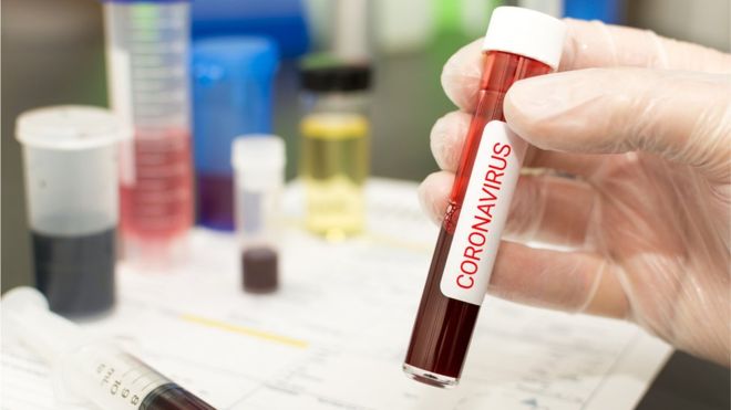 Teste de coronavirus Universidade Rutgers desenvolve teste de coronavírus pela saliva