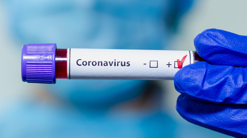 Teste de coronavirus 1 1 Mortes por coronavírus faz 4.202 vítimas em New Jersey 
