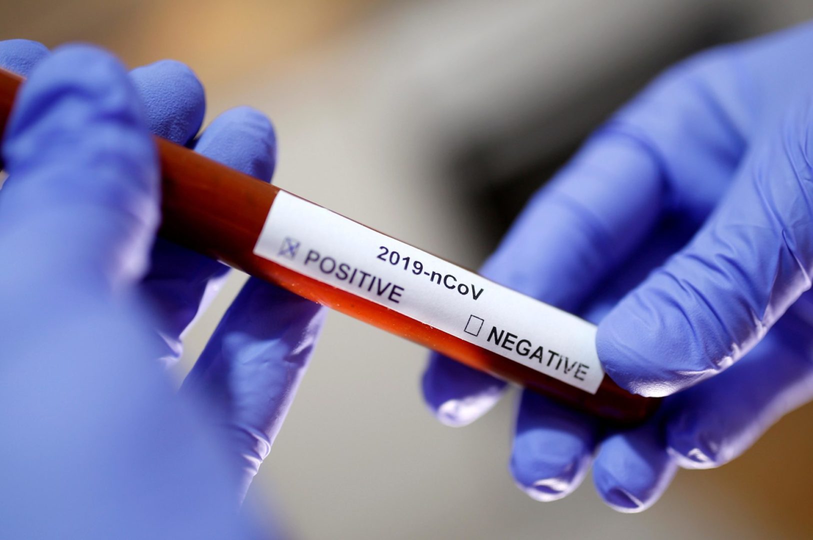 Coronavirus teste 1 1 scaled Laboratório anuncia resultados positivos de vacina contra o coronavírus