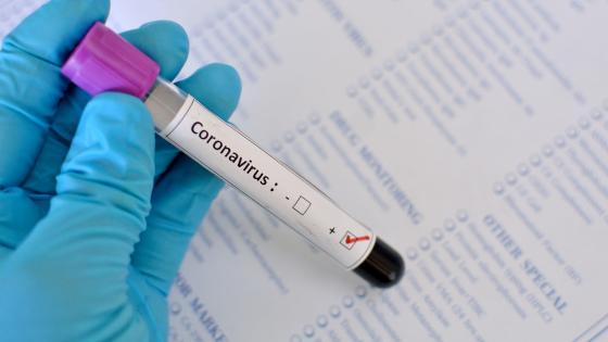 Coronavirus teste Flórida bate outro recorde de coronavírus após reabertura da economia